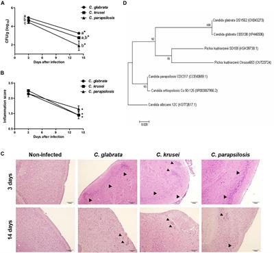 Differential Behavior of Non-albicans Candida Species in the Central Nervous System of Immunocompetent and Immunosuppressed Mice